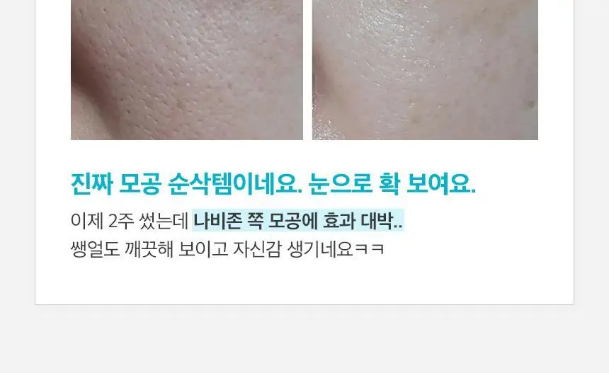 [모공수축] 셀올로지 포어샷 MTS (MTS/앰플/카트리지) 상세페이지 17